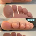 指先の角質が気になる