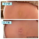 くり返す魚の目